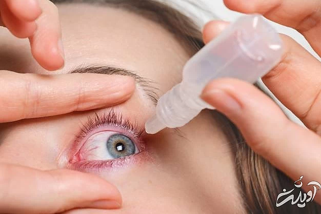 ریختن چسب ناخن در چشم